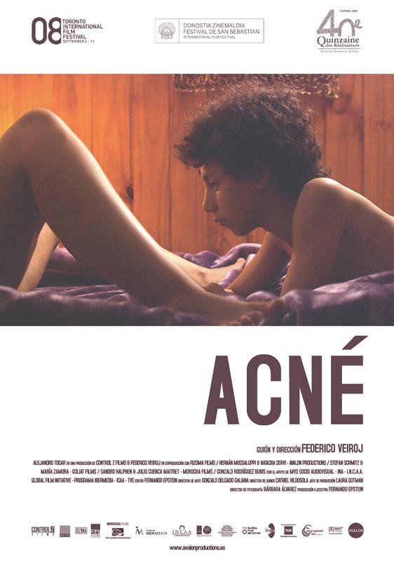 Poster Acne